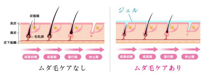 子どものムダ毛に悩んだら 抑毛 よくもう という手段はどうですか 暮らしの音 Kurashi Note