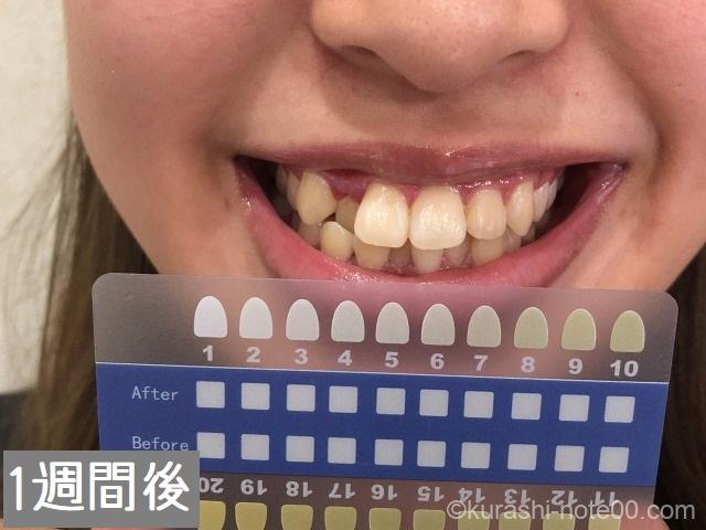 シローズ1週間後